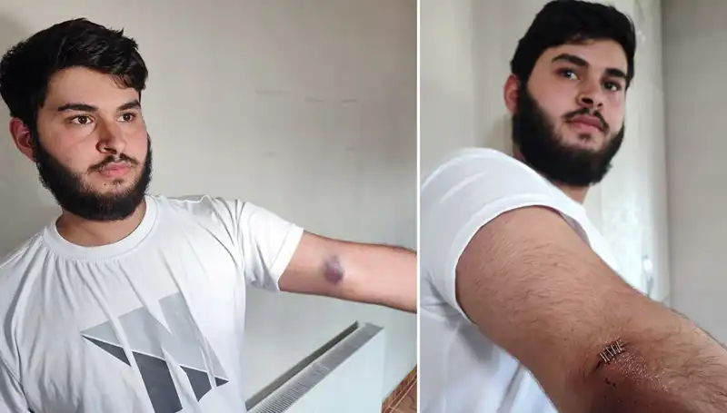 Mahallede Top Krizi: Conoların Kamyonetle Geldiği Olay