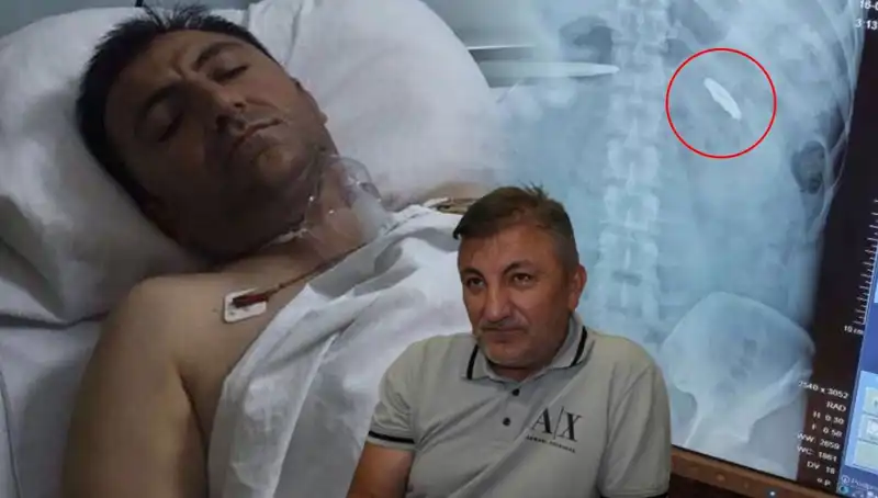 15 Temmuz’un Acı İzleri: 9 Yıldır Kurşunla Yaşayan Bir Hayat
